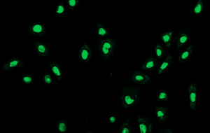 Sothys ROS immunostaining
in primary cells