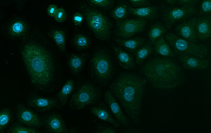 sdtsts Immunostaining of mitophagy markers in primary cells