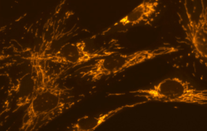 sdtstsdfst Immunostaining of damaged mitochondria in primary cells