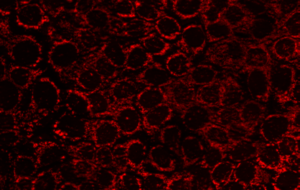 sdtstsdfstsyssdwry Immunostaining of damaged mitochondria in primary cells