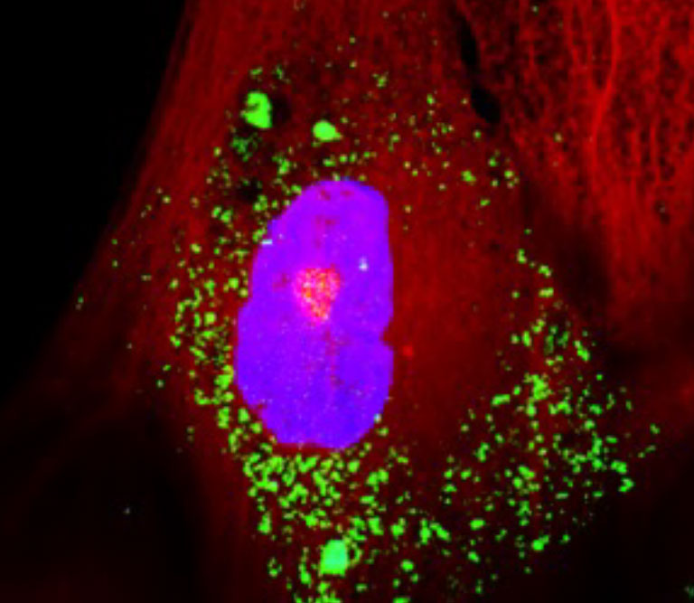 Exosomes-Imaging