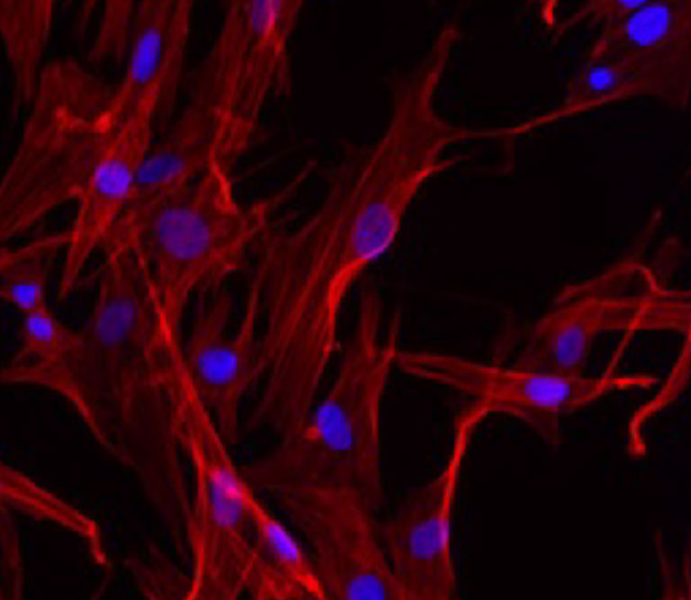 Fibroblasts