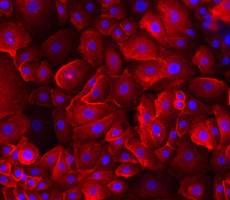 Kératinocytes