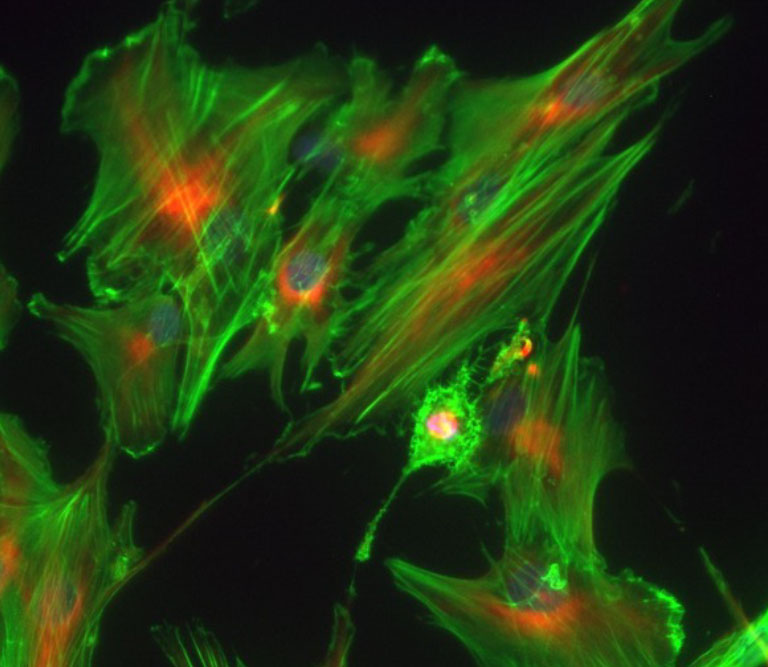 Mesenchymal-stem-cell