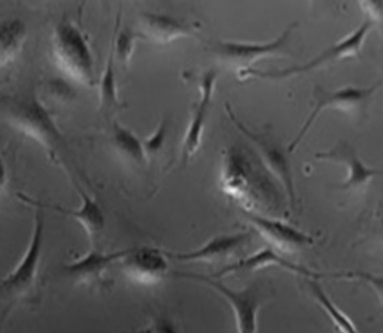 cellule-enditheliale