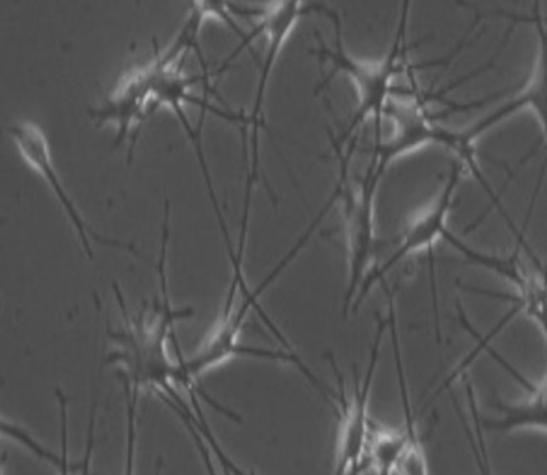 vignette Melanocytes