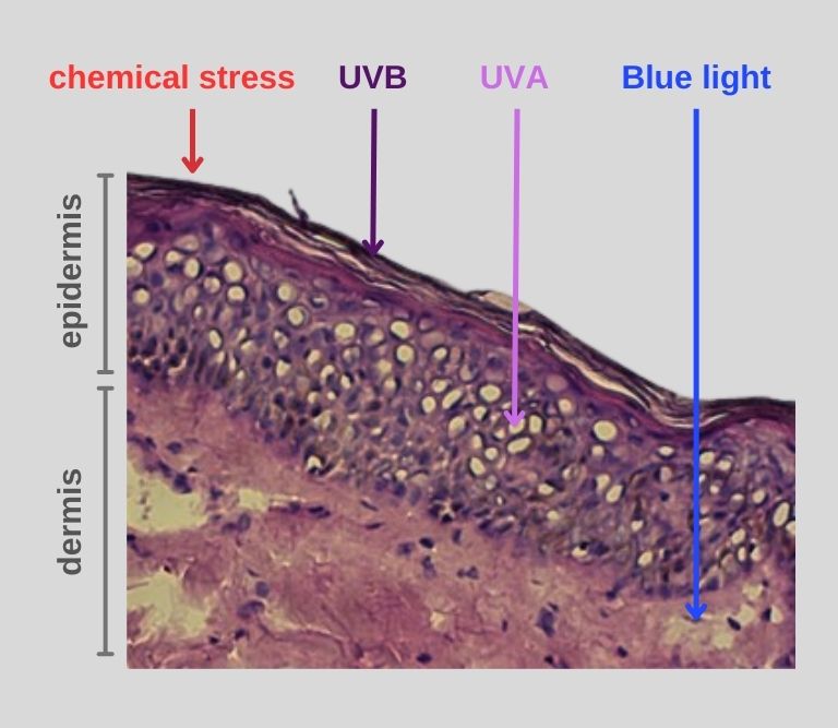 Vignette Stress uv